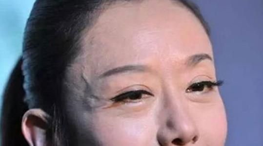 女人遷移宮有青筋的面相是什么意思,青筋面相好不好(圖文)