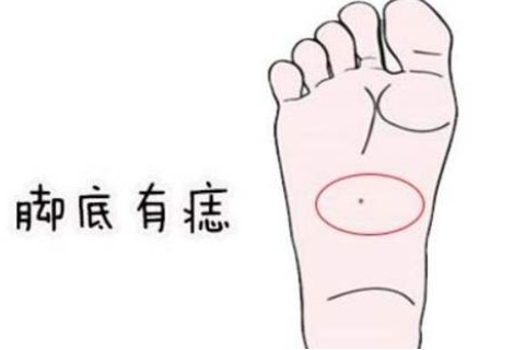 女人身上痣面相分析