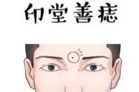 男人印堂有痣代表什么？