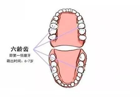 孩子換牙八字牙