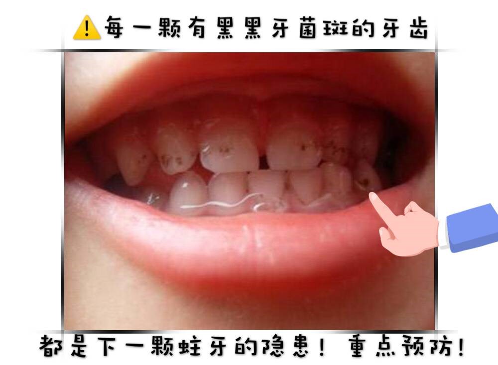 孩子換牙八字牙_小孩一般換牙換幾顆牙_小孩換牙很久不長新牙