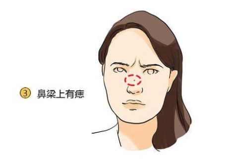 左鼻梁有痣的女人面相如何