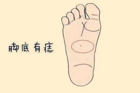 女人右腳底痣好不好？