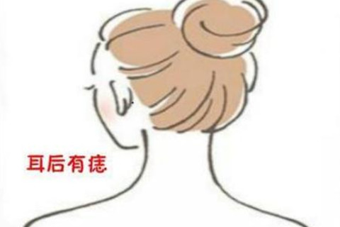 耳朵后面有痣代表什么？