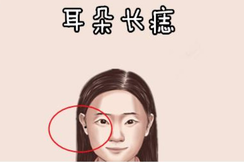 女人耳朵長(zhǎng)痣說明了什么？